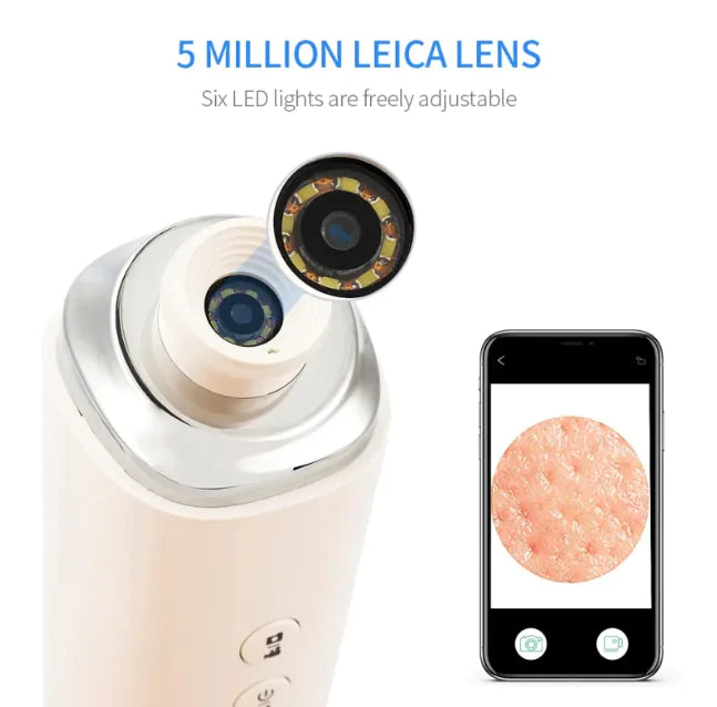 HD Blackhead Remover & Pore Vacuum